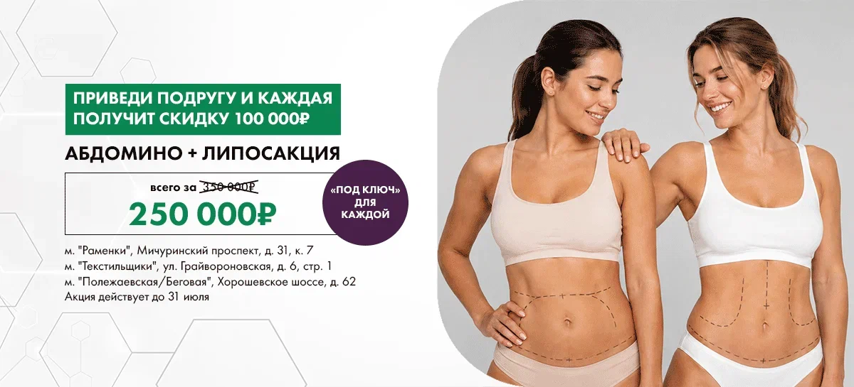 Скидка 100 000 ₽ на абдоминопластику с липосакцией «под ключ»!