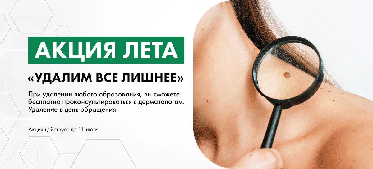 Акция «Удалим все лишнее»