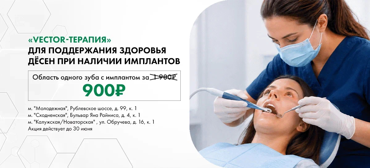 «Vector-терапия» для поддержание здоровья дёсен при наличии имплантов
