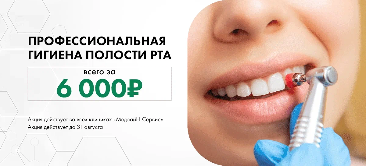 Профессиональная гигиена за 6.000₽