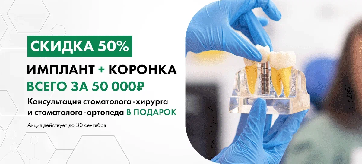 Имплант+коронка "под ключ"